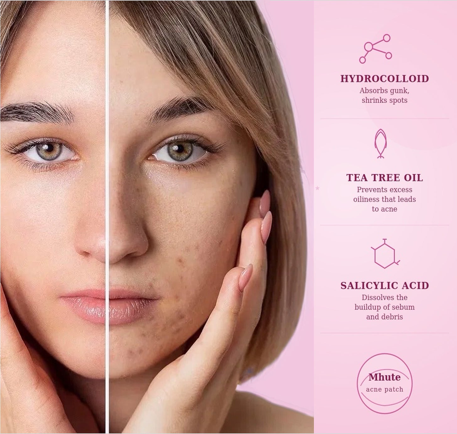 Acne Patch